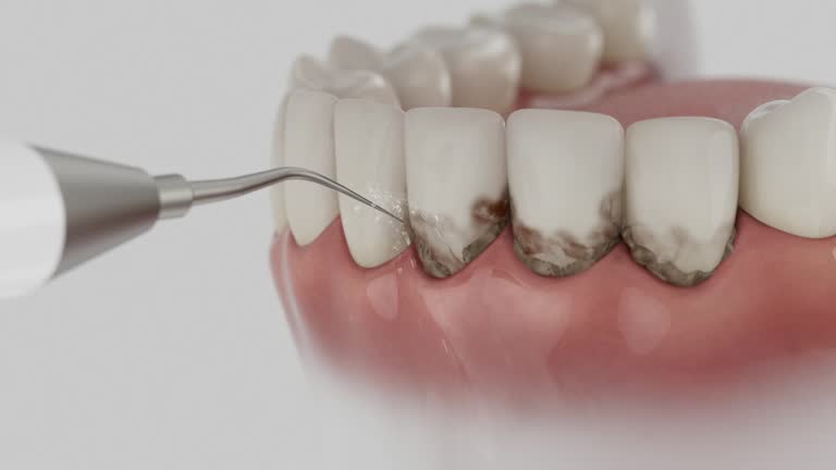 Reliable Tooth Extraction contractor in Tennessee, TN by Dentist Open Now